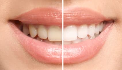 Cosmetic Dentistry